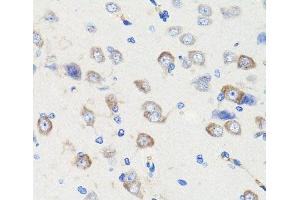 Immunohistochemistry of paraffin-embedded Rat brain using DLG1 Polyclonal Antibody at dilution of 1:100 (40x lens). (DLG1 抗体)