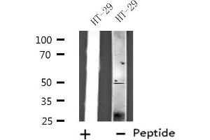 Western blot analysis of extracts from HT-29 cells, using ZFYVE19 antibody. (ZFYVE19 抗体  (Internal Region))