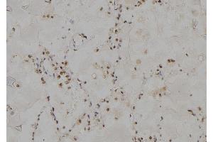 ABIN6264480 and ABIN6277000 at 1/100 staining Human lung tissue by IHC-P. (PSMC3 抗体  (Internal Region))