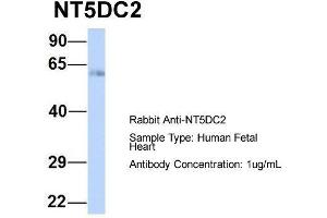 Host:  Rabbit  Target Name:  NT5DC2  Sample Type:  Human Fetal Heart  Antibody Dilution:  1. (NT5DC2 抗体  (N-Term))