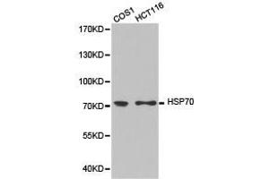 Western Blotting (WB) image for anti-Heat Shock Protein 70 (HSP70) antibody (ABIN1873094) (HSP70 抗体)