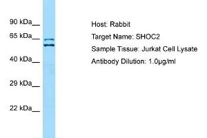 Host: RabbitTarget Name: SHOC2Antibody Dilution: 1. (SHoc2/Sur8 抗体  (N-Term))