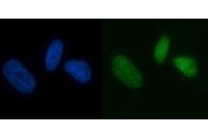 IF analysis of MCM7 using anti-MCM7 antibody (ABIN7601968). (MCM7 抗体  (AA 526-719))