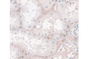 DAB staining on IHC-P; Samples: Human Kidney Tissue. (HPR 抗体  (AA 70-332))