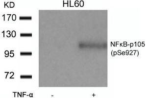 Western blot analysis of extracts from HL60 cells untreated or treated with TNF-a using NFkB-p105(Phospho-Ser927) Antibody.