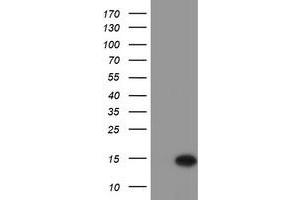 Western Blotting (WB) image for anti-Chromosome 17 Open Reading Frame 37 (C17orf37) antibody (ABIN1501780) (C17orf37 抗体)