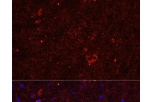 Immunofluorescence analysis of Rat brain using GRIA2 Polyclonal Antibody at dilution of 1:50. (GRIA2 抗体)