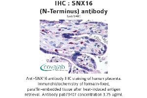 Image no. 2 for anti-Sorting Nexin 16 (SNX16) (N-Term) antibody (ABIN1739488) (SNX16 抗体  (N-Term))