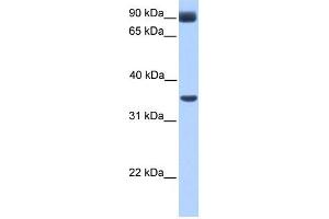 WB Suggested Anti-CIR Antibody Titration:  0. (KCNJ5 抗体  (Middle Region))