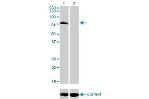 Western blot analysis of AKAP10 over-expressed 293 cell line, cotransfected with AKAP10 Validated Chimera RNAi (Lane 2) or non-transfected control (Lane 1). (AKAP10 抗体  (AA 1-100))