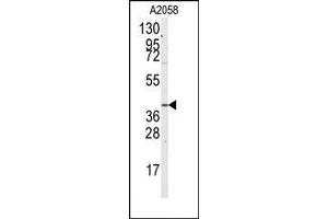 Image no. 1 for anti-Guanine Nucleotide Binding Protein (G Protein) alpha 12 (GNA12) (Ser67) antibody (ABIN360476)
