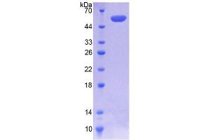 SDS-PAGE analysis of Human COQ6 Protein. (COQ6 蛋白)