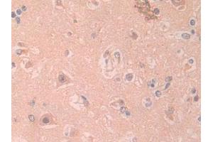 DAB staining on IHC-P; Samples: Human Cerebrum Tissue (IL1RAPL2 抗体  (AA 161-330))