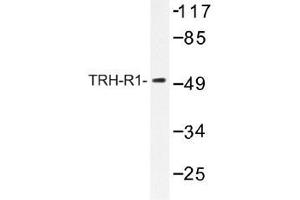 Image no. 1 for anti-Thyrotropin-Releasing Hormone Receptor (TRHR) antibody (ABIN317876) (TRHR 抗体)