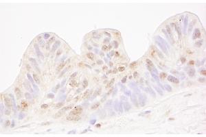 Immunohistochemistry (IHC) image for anti-Methyl-CpG Binding Domain Protein 4 (MBD4) (AA 1-50) antibody (ABIN7448644) (MBD4 抗体  (AA 1-50))