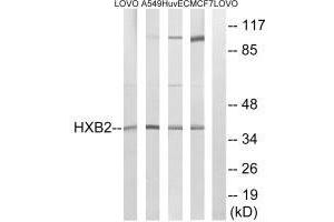 Western blot analysis of extracts from LOVO cells, A549 cells, HUVEC cells and MCF-7 cells, using HOXB2 antibody. (HOXB2 抗体)