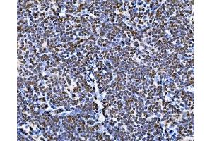 IHC analysis of BUB1 using anti-BUB1 antibody (ABIN7600942).