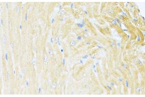 Immunohistochemistry of paraffin-embedded Mouse heart using UQCC2 Polyclonal Antibody at dilution of 1:100 (40x lens). (MNF1 抗体)