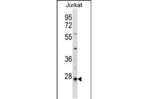 Western blot analysis in Jurkat cell line lysates (35ug/lane).