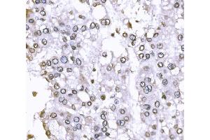 IHC analysis of SUN2 using anti-SUN2 antibody (ABIN7601278).