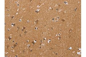 The image on the left is immunohistochemistry of paraffin-embedded Human brain tissue using ABIN7128941(CHRNA4 Antibody) at dilution 1/20, on the right is treated with fusion protein. (CHRNA4 抗体)