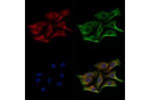 ABIN6259848 and ABIN6278812 staining Hela cells by IF/ICC.
