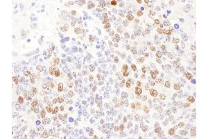Immunohistochemistry (IHC) image for anti-Deoxycytidine Kinase (DCK) (AA 210-260) antibody (ABIN7453430) (DCK 抗体  (AA 210-260))