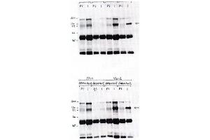 Image no. 1 for anti-Vav 2 Guanine Nucleotide Exchange Factor (VAV2) antibody (ABIN264963) (VAV2 抗体)