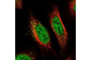 Immunofluorescent staining of human cell line U-2 OS with PRCC polyclonal antibody  at 1-4 ug/mL dilution shows positivity in nucleus but not nucleoli and vesicles. (PRCC 抗体)