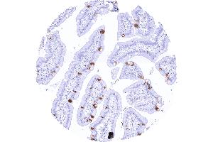 Duodenal mucosa with a moderate to strong TFF1 positivity of selected goblet cells (TFF1 抗体  (AA 1-88))