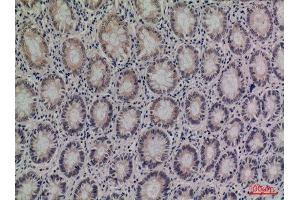 Immunohistochemistry (IHC) image for anti-serpin Peptidase Inhibitor, Clade A (Alpha-1 Antiproteinase, Antitrypsin), Member 4 (SERPINA4) (Internal Region) antibody (ABIN6281470)