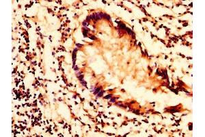 IHC image of ABIN7163362 diluted at 1:200 and staining in paraffin-embedded human appendix tissue performed on a Leica BondTM system. (PLTP 抗体  (AA 18-493))