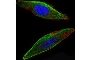 Immunofluorescence (IF) image for anti-Colony Stimulating Factor 1 Receptor (CSF1R) (AA 895-923), (C-Term) antibody (ABIN657832)