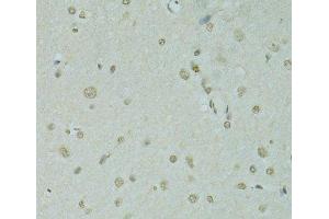 Immunohistochemistry (Paraffin-embedded Sections) (IHC (p)) image for anti-Scaffold Attachment Factor B (SAFB) antibody (ABIN7263975)