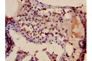Immunohistochemistry of paraffin-embedded human testis tissue using ABIN7172499 at dilution of 1:100 (TFDP3 抗体  (AA 61-196))