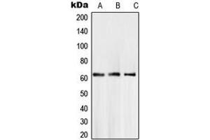 Western blot analysis of SMAD6 expression in A204 (A), LN18 (B), L929 (C) whole cell lysates. (SMAD6 抗体  (Center))