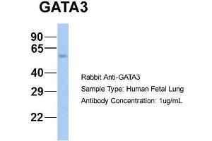 Western Blotting (WB) image for anti-GATA Binding Protein 3 (GATA3) (N-Term) antibody (ABIN2777460)