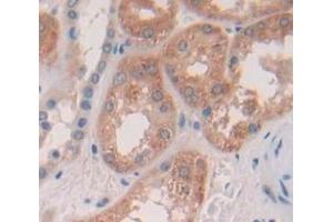 Used in DAB staining on fromalin fixed paraffin- embedded Kidney tissue (PRDM14 抗体  (AA 395-568))