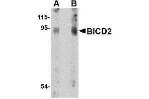 Western blot analysis of BICD2 in A549 cell lysate with AP30145PU-N BICD2 antibody at (A) 1 and (B) 2 μg/ml. (BICD2 抗体  (C-Term))