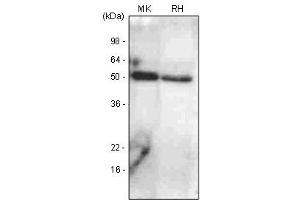 The extracts of mouse kidney (Mk) and rat heart (RH) were resolved by SDS-PAGE, transferred to PVDF membrane and probed with anti-human BMP7 antibody (1:1,000). (BMP7 抗体  (AA 293-431))