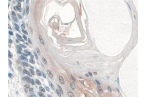 Immunohistochemistry (IHC) image for anti-Barrier To Autointegration Factor 1 (BANF1) (AA 2-89) antibody (ABIN7444295)