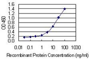 Detection limit for recombinant GST tagged PLS3 is 0. (Plastin 3 抗体  (AA 1-630))