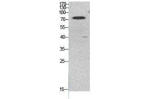 Western Blot (WB) analysis of HeLa cells using Acetyl-Ub (K48) Polyclonal Antibody. (Ubiquitin 抗体  (acLys48))