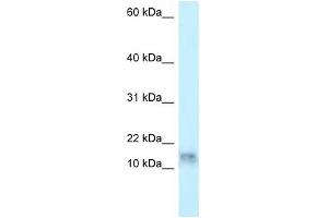 Western Blot showing DNAL1 antibody used at a concentration of 1 ug/ml against HepG2 Cell Lysate (DNAL1 抗体  (N-Term))