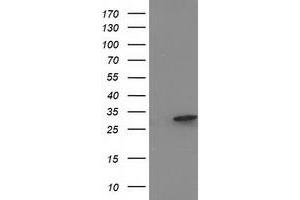 Western Blotting (WB) image for anti-Eukaryotic Translation Initiation Factor 4E Family Member 2 (EIF4E2) antibody (ABIN1497993) (EIF4E2 抗体)
