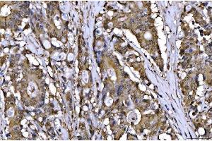 IHC analysis of AHA1/AHSA1 using anti-AHA1/AHSA1 antibody (ABIN7600708).