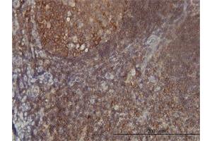 Immunoperoxidase of monoclonal antibody to FARSLB on formalin-fixed paraffin-embedded human tonsil tissue. (FARSB 抗体  (AA 234-341))