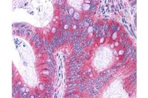 Immunohistochemistry (IHC) image for anti-Nuclear Factor-kB p65 (NFkBP65) (C-Term) antibody (ABIN964680)