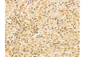 ABIN7094351 and ABIN7098398 at 1/100 staining Rat kidney tissue by IHC-P. (MED10 抗体  (Internal Region))