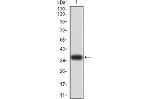 Western blot analysis using HAVCR1 mAb against human HAVCR1 (AA: 70-290) recombinant protein.
